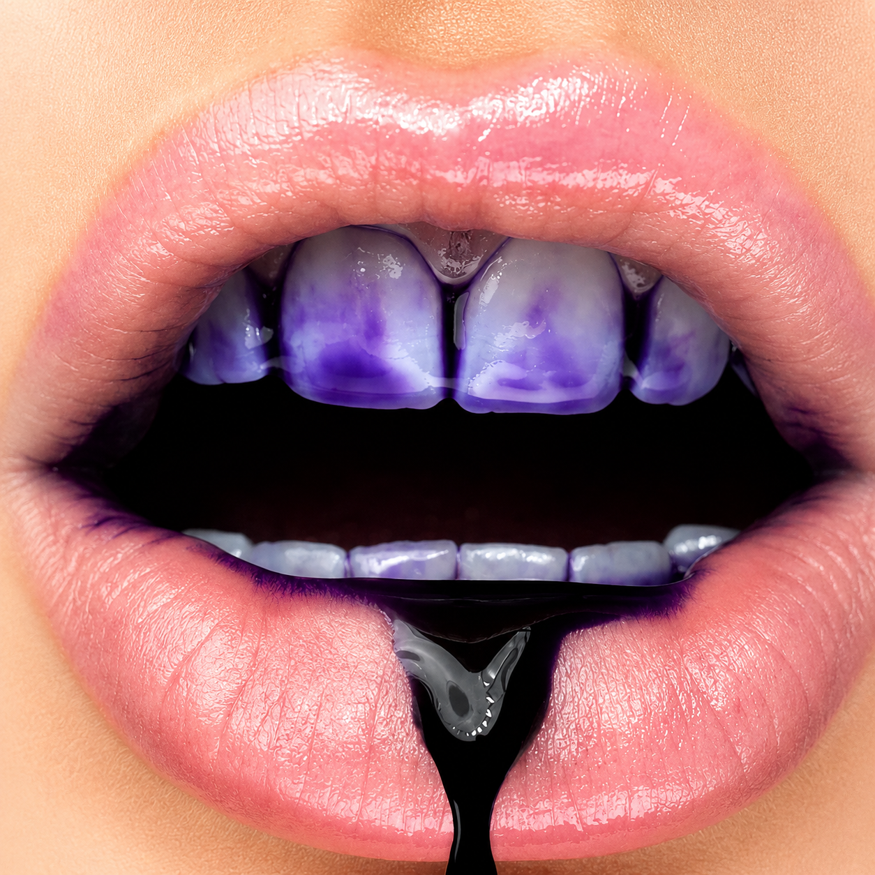 PURPLE V34 - El #1 En Blanqueadores Dentales
