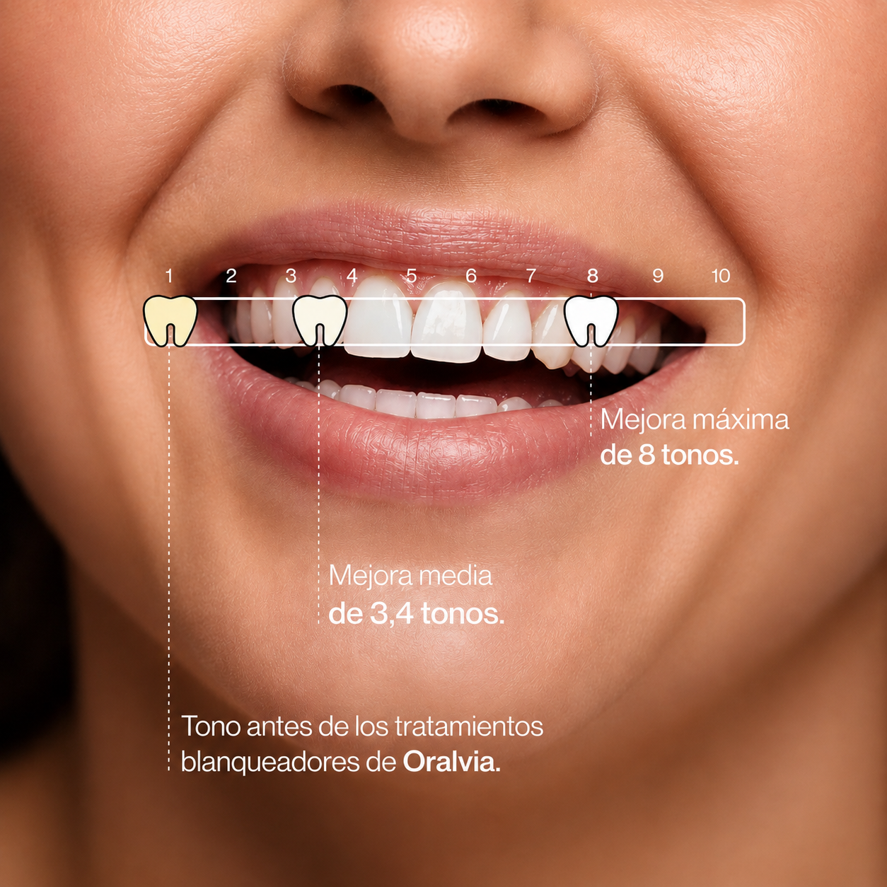 PURPLE V34 - El #1 En Blanqueadores Dentales